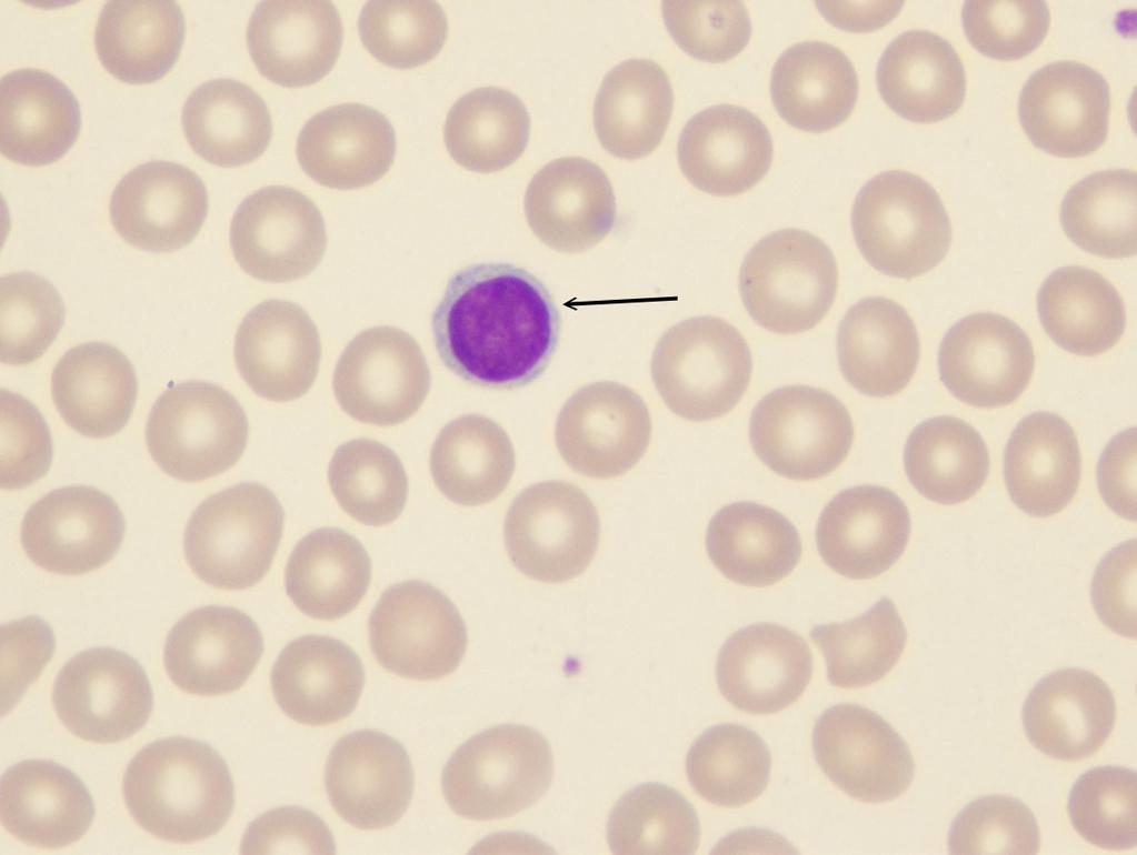 Lymfocyte