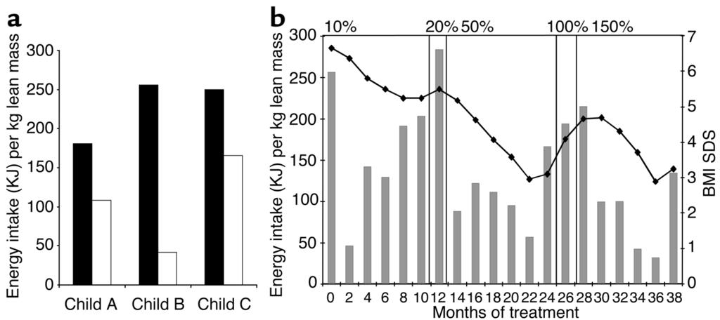 Figure 2 Effects of r-methuleptin therapy on energy intake. (a) Energy intake at an ad libitum test meal before (black bars) and 2 months after (white bars) r-methuleptin therapy in child A, B, and C.