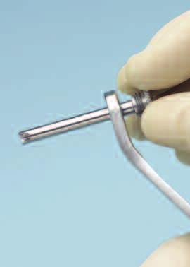 Fixation Using Schanz Screws 6 Make small stab incision Prepare for Schanz screw insertion by