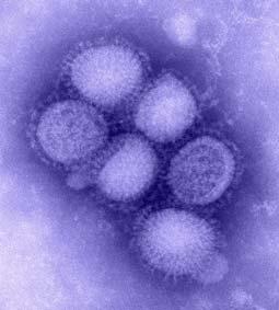 Pandemic Influenza A (H1N1) US Cases First human cases noted in Mexico First human cases in