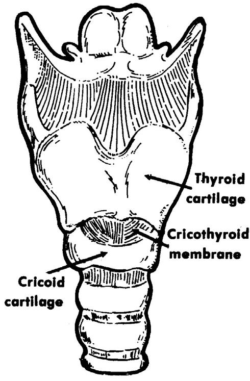 LESSON 3 CRICOTHYROIDOTOMY Section I. GENERAL CONSIDERATIONS 3-1.