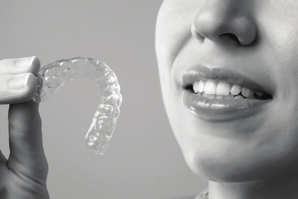 Time Saver Straightens teeth faster.