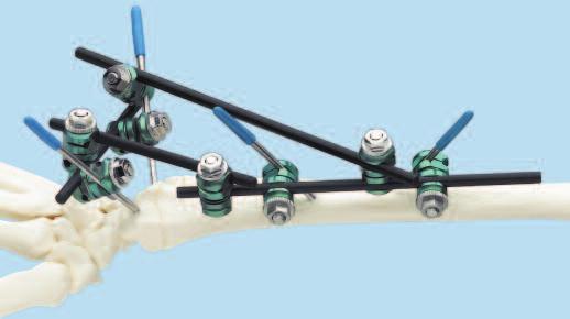 Ensure that all clamps are tight. See Optional Frame Configurations page for sample frames.