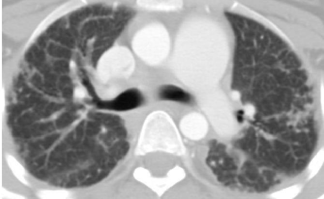 and Coronal CT and HRCT