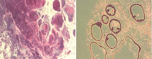 Figure 4: Expression of middle T antigen, detected by in situ hybridization, in the dorsal prostate adjacent to
