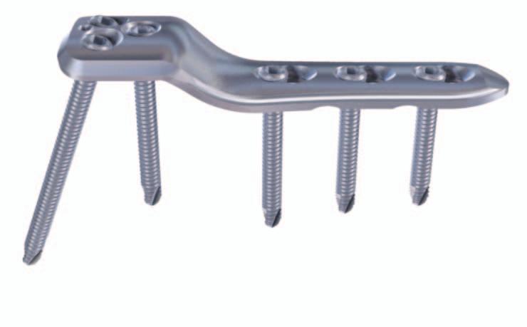 Pediatric LCP Hip Plate The Pediatric LCP Hip Plate System is designed for stable fixation of varus, valgus or rotational osteotomies and trauma applications in pediatric orthopaedics and is designed