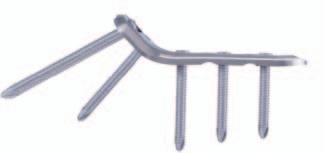 For valgus osteotomies The plate is available with a screw angle of 150.