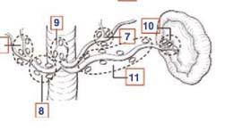 lymphadenetomy is an extended LN dissection that entails removing all nodes along the