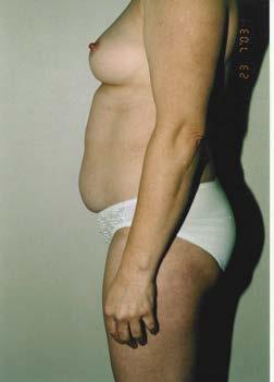 self esteem and motivation Body weight Abdomen Hips