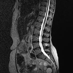 Standing Spinal