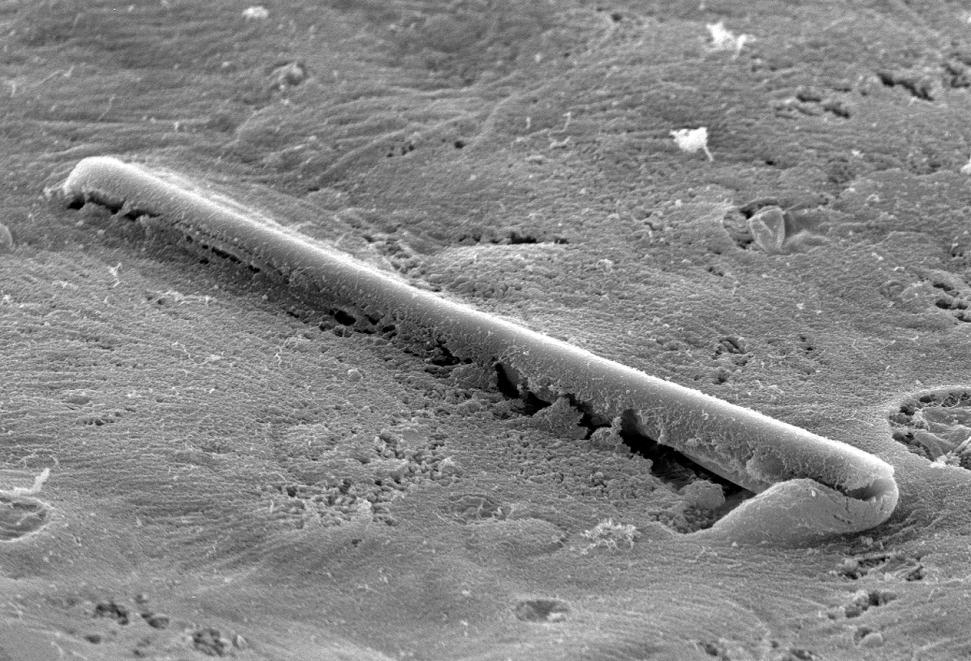 Inhaled particles in the lung 5 µm