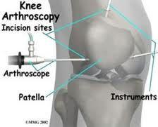 Arthroscopic Surgery The physicians and surgeons at Orthopaedic Asssociates of Central Texas (OACT) are leaders in caring for the joints of the body.