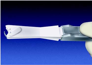 surgical technique introduction The CurvTek System combines the benefits of preferred soft tissue reattachment with innovative pneumatic