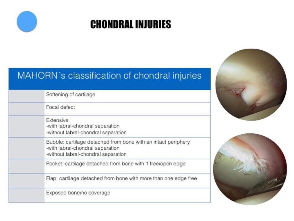 Fig. 40: MAHORN s classification of chondral injuries.