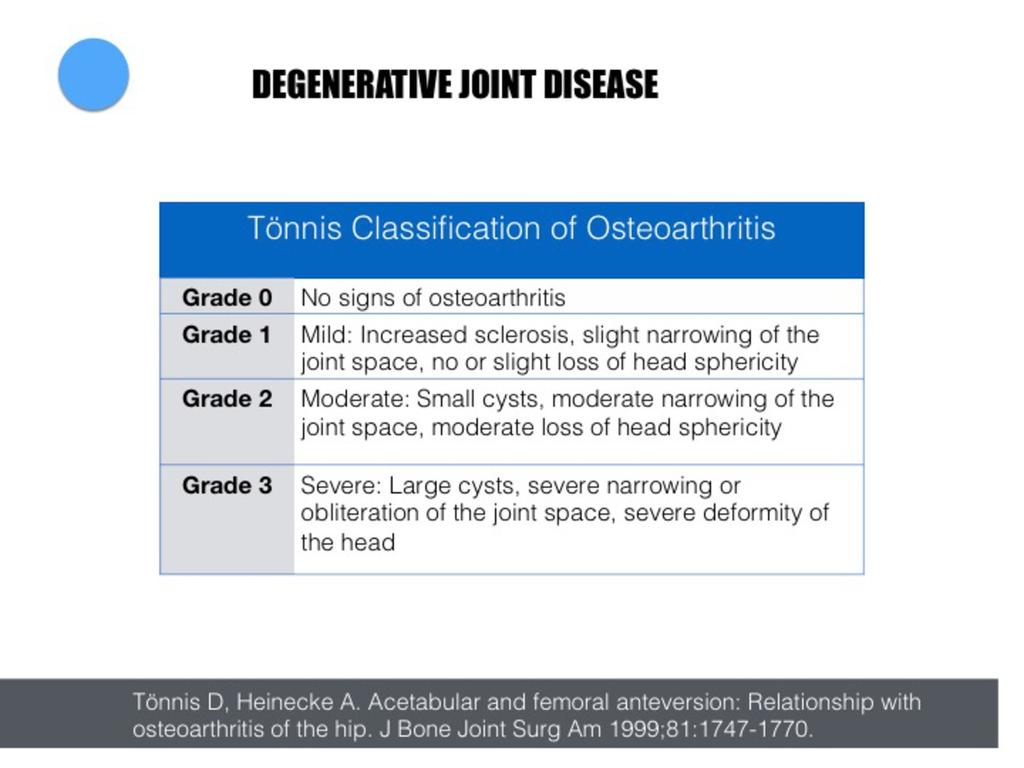 Fig. 56: Tönnis classification of osteoarthritis. It is the most commonly used in the arthroscopic literature. Initially radiographically based.