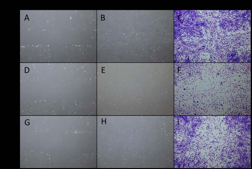 Efficacy Data Protocol Human dermal fibroblasts were seeded into 6-well tissue culture plates 0.