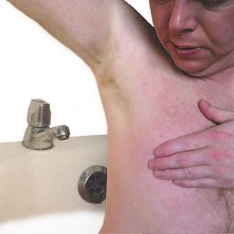 Male Breast Awareness