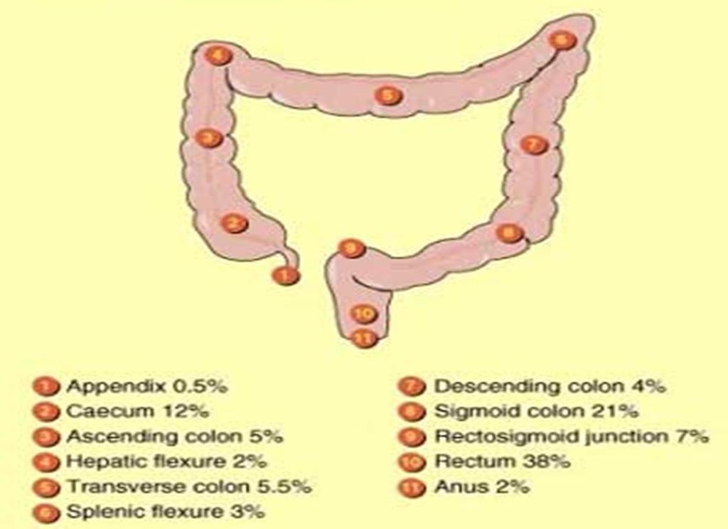 Colorectal Cancer Symptoms Change in bowel habit closer to the anus the more symptoms change in frequency or consistency of stool Rectal bleeding overt or occult bright red, purple, black, not