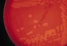 Laboratory Diagnosis: Group B b-hemolytic Streptococcus Colony morphology Grayish-white, mucoid,