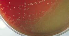 Laboratory Diagnosis: Streptococcus Group D and Enterococcus Species Microscopic morphology Cells tend to elongate