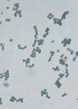 Streptococcus and Enterococcus: General Characteristics Gram-positive,