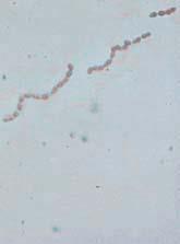 Streptococcus and Enterococcus: General Characteristics Appear in chains