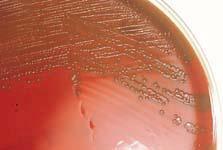 Streptococcus and Enterococcus: Hemolytic Patterns Alpha (a):hemolysis showing a greenish