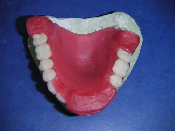 Teeth are set-up on the model in the edentulous