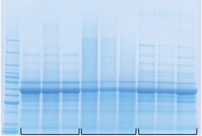 Protein Composition of OrthoFlo The protein composition of amniotic fluid, OrthoFlo and synovial fluid were compared by gel electrophoresis (Figure 3).
