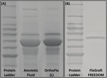 COMPETITIVE COMPARISONS The protein composition of OrthoFlo was compared to a variety of flowable placental tissue products currently on the market claiming to be composed of amniotic fluid.