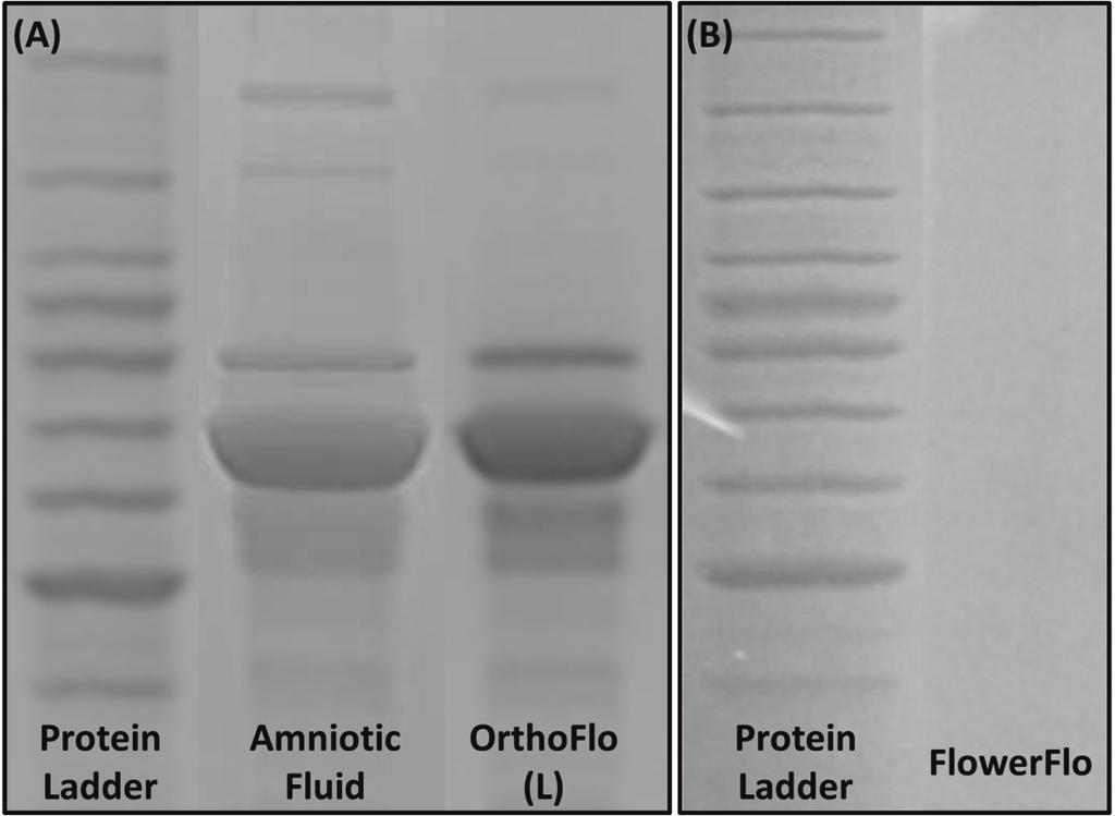 OrthoFlo Comparison to FlowerFlo FlowerFlo placental tissue matrix allograft is processed by Human Regenerative Technologies, LLC (HRT; El Segundo, CA) and distributed by Flower Orthopedics (Horsham,