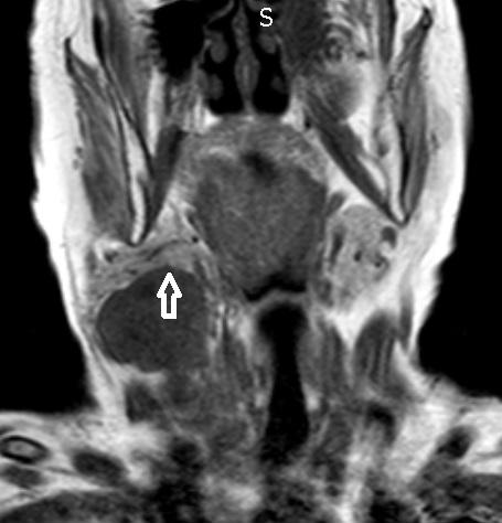 Figure 1 Preoperative appearance of the patient was seen.