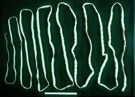 In the intestines Adult tapeworm from the