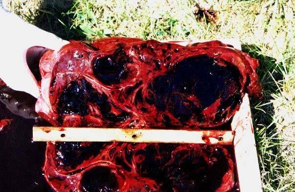 Liver parasite Liver damage caused by acute fluke