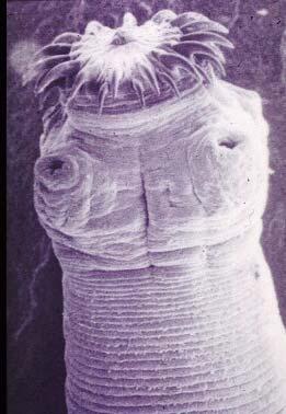Attachment organs The adult tapeworm has hooks and