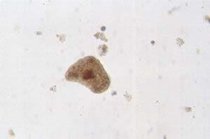 protozoan Entamoeba attacks host tissues in the