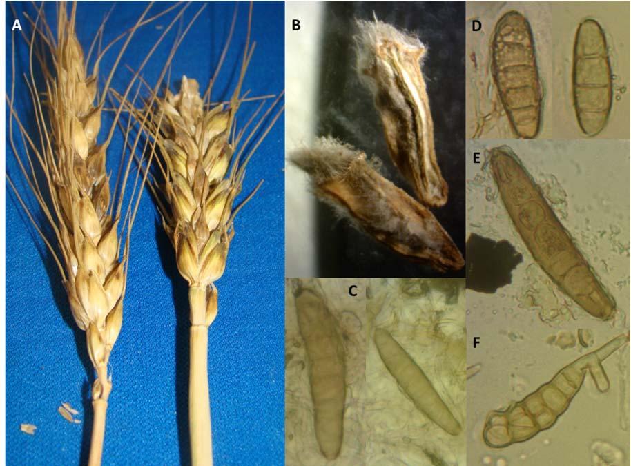 Any seeds that were infected and rotting were found to be infected by Drechslera sp. (Figure 4) Figure 4. Symptoms and signs observed from the glume of wheat A.