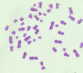 Chromosome abnormalities were classified as follows: dicentric chromosomes and rings, which were only considered when an acentric fragment was present.
