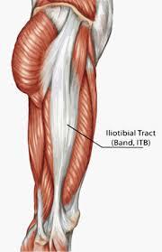 IT Band Syndrome- basic anatomy Connective tissue which originates at the hip and travels along the outside of