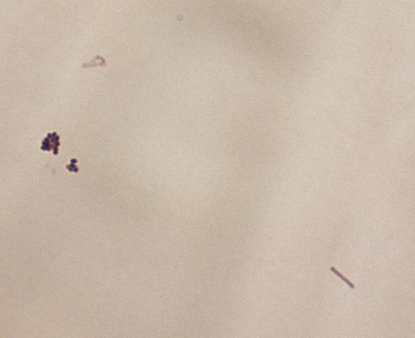 Sample 13/2013 Tissue sample from leg. Gram-staining of the native specimen 1 2 1.