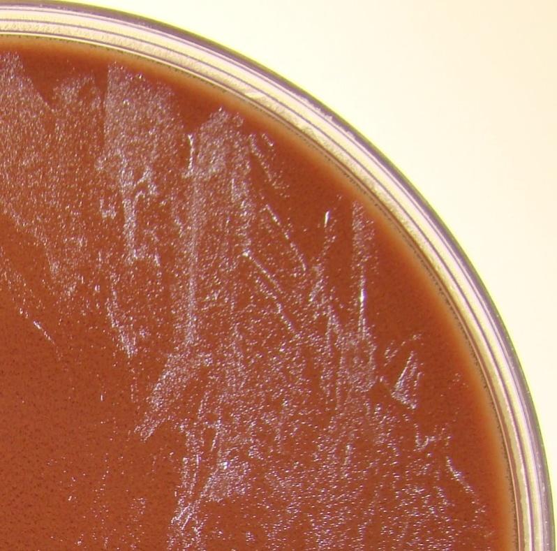 agar and chocolated blood agar plates in 5% CO