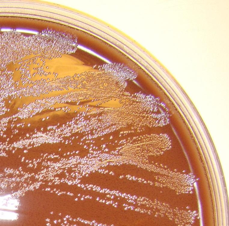agar and chocolated blood agar plates in 5% CO 2