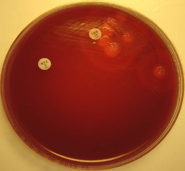 Sample 13/2013. Tissue sample from leg. Anaerobic primary culture Anaerobic growth on an anaerobic blood agar plate (FAA) after 48 hours at 35 C.