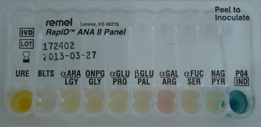 Sample 13/2013. Clostridium novyi 1. RapID ANA II 000144 Clostridium tetani (99 %), But the positive indole reaction is not right.