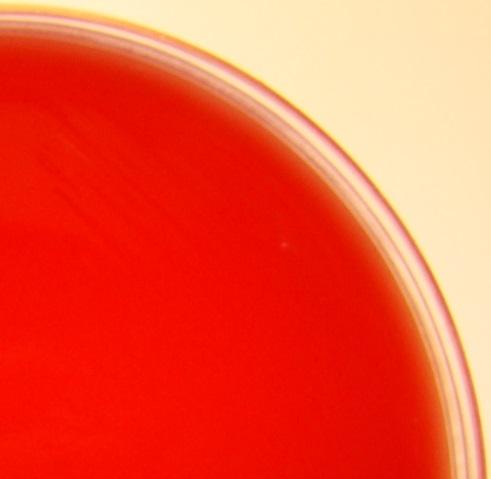 Chocolated blood agar (in the middle): No