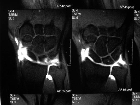 Investigations MRI vs arthroscopy