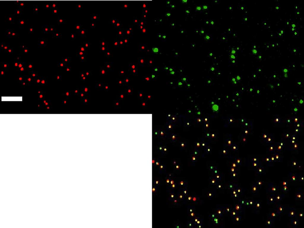 Darkﬁeld image, ﬂuorescence image, overlay and colocalization statistics (clockwise top left to bottom right) for (c) AVN1 and (d).