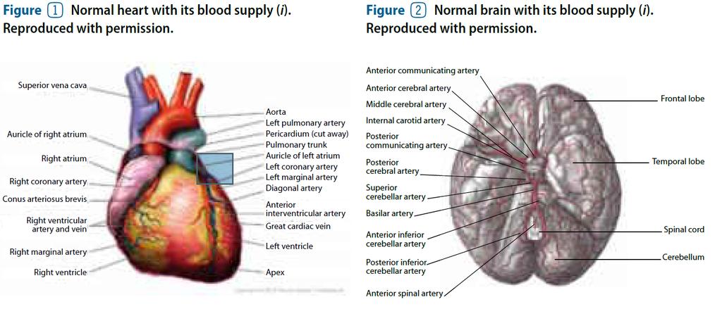 Heart and Brain WHO.
