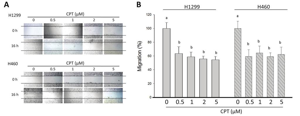 INTERNATIONAL JOURNAL OF ONCOLOGY 5 Figure 2. (A) Migration of H1299 and H460 cells following CPT treatment for 16 h was determined using a wound-healing assay. Magnification, x100.
