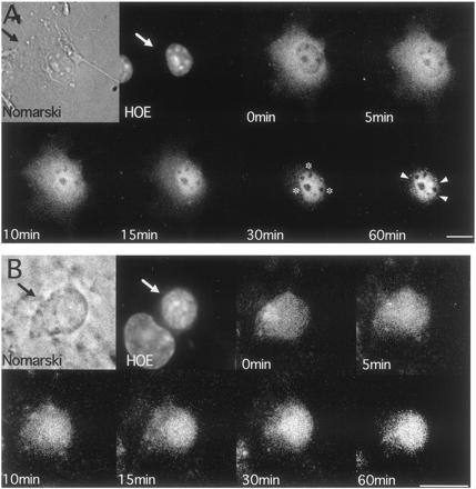 Dinamične spremembe v subcelularni lokalizaciji mineralokortikoidnega receptorja (MR-YFP) v živih